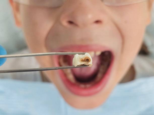 Best Pediatric Emergency Dentist in Navarre Beach, FL